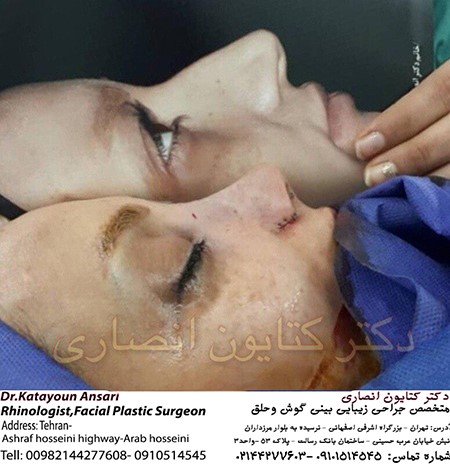 بهترین جراح بینی تهران